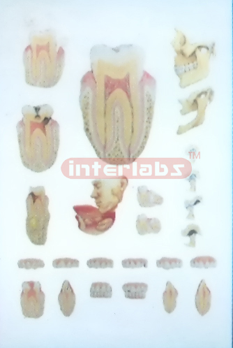 HANGING HUMAN DEMONSTRATING MODEL OF THE TEETH AND JAW